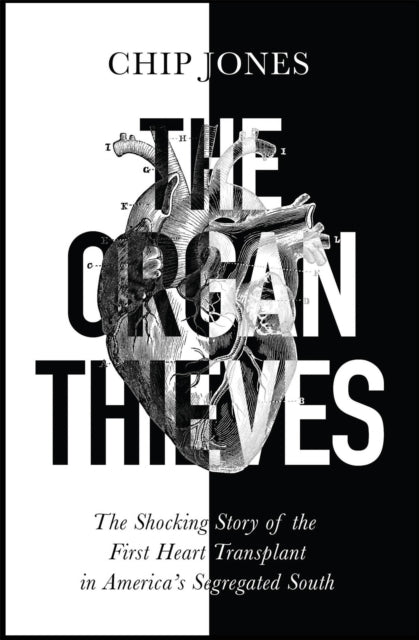 The Organ Thieves: The Shocking Story of the First Heart Transplant in America&#39;s Segregated South - Chip Jones